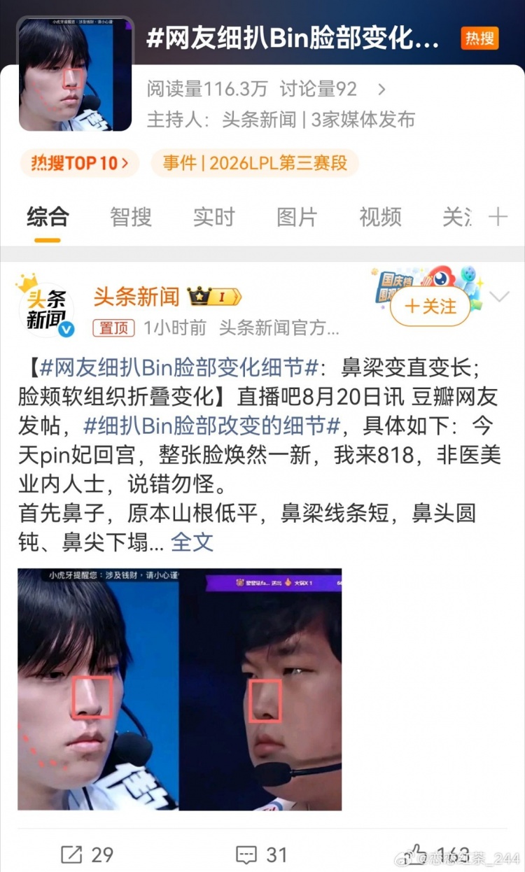【蜗牛电竞】LPL顶流的待遇:三家官媒蓝V一同下场,齐推话题“Bin脸部细节”